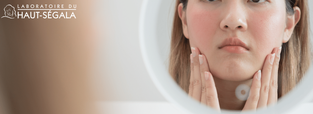 Femme observant une peau sensible et rouge dans un miroir, image illustrant les soins apaisants du Laboratoire Haut-Ségala.